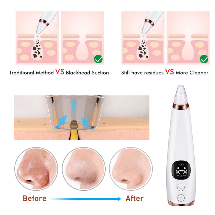 Facial Instrument Cleanser – Luxus Gesichtsreinigungsgerät für professionelle Hautpflege