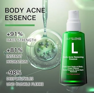 Body Pimple Repair Moisturizer - Klärende Luxuspflege gegen Körperunreinheiten