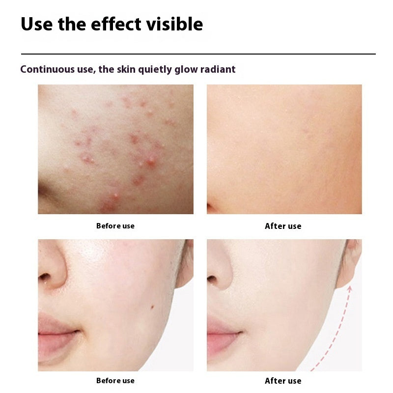 Photon Specific Skincare Introduction Device Massage 