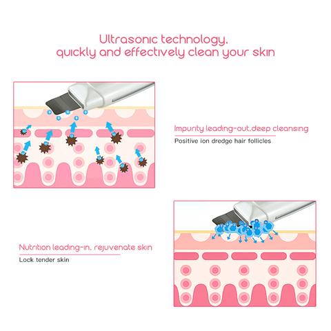 Ultrasonic Skin Scrubber Pro™ – Deep cleansing &amp; skin rejuvenation at studio level 