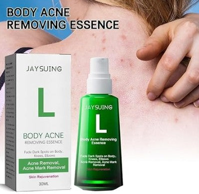 Body Pimple Repair Moisturizer - Klärende Luxuspflege gegen Körperunreinheiten